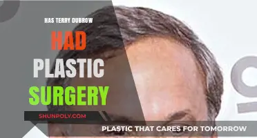 Terry Dubrow's Transformation: Unveiling the Truth About His Plastic Surgery