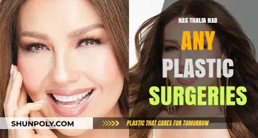 Thalia's Transformation: Unveiling the Truth About Her Plastic Surgery Rumors