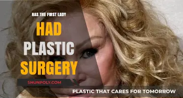 First Lady's Appearance: Plastic Surgery Speculations and Public Curiosity