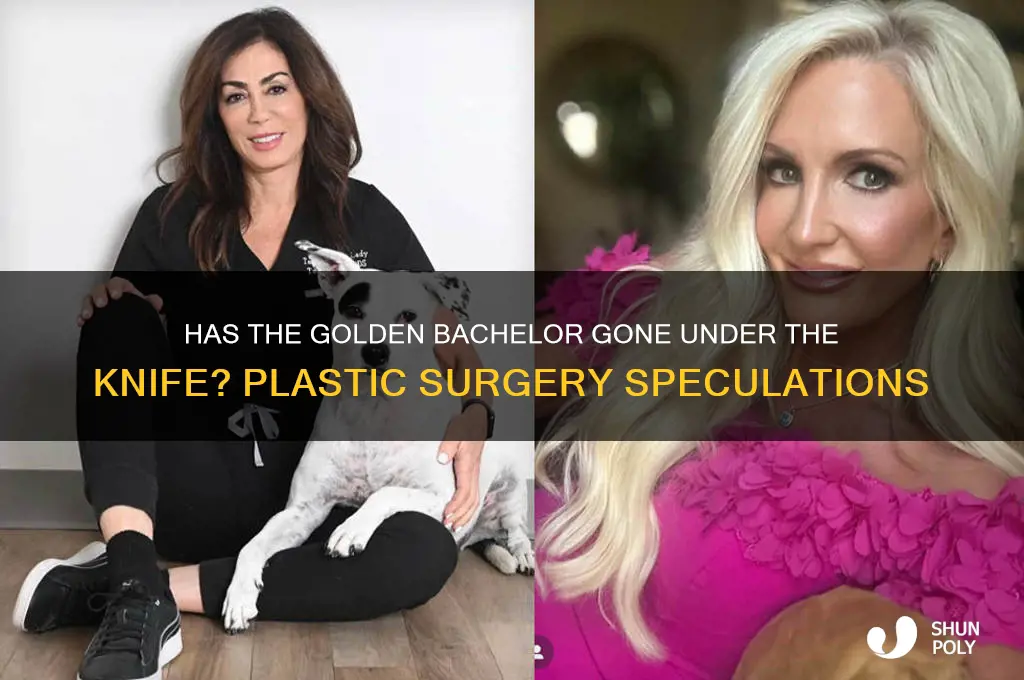 has the golden bachelor had plastic surgery