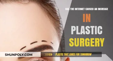 Internet Influence: Surging Plastic Surgery Trends in the Digital Age