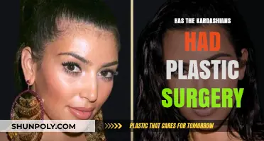 The Truth About the Kardashians and Plastic Surgery: Fact or Fiction?