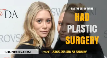 Olsen Twins Plastic Surgery: Fact or Fiction? Unveiling the Truth