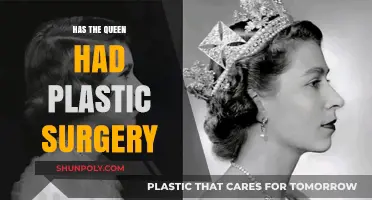 Has Queen Elizabeth II Undergone Plastic Surgery? Exploring the Rumors