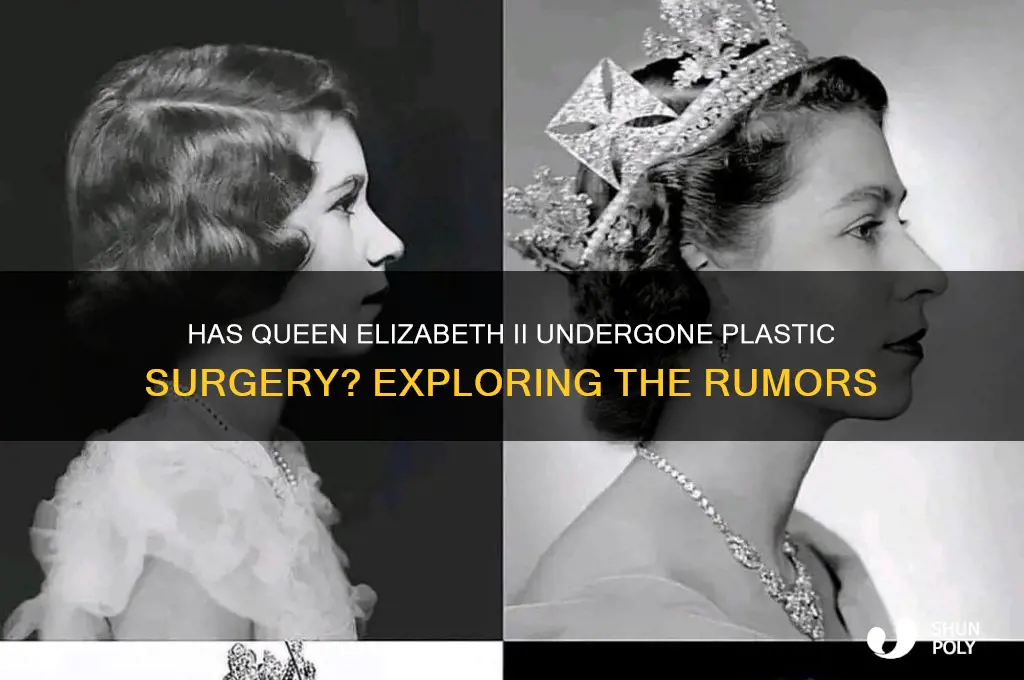 has the queen had plastic surgery