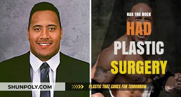 The Rock's Transformation: Plastic Surgery Rumors Explored and Debunked