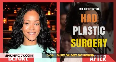 Has The Situation Had Plastic Surgery? Uncovering the Truth