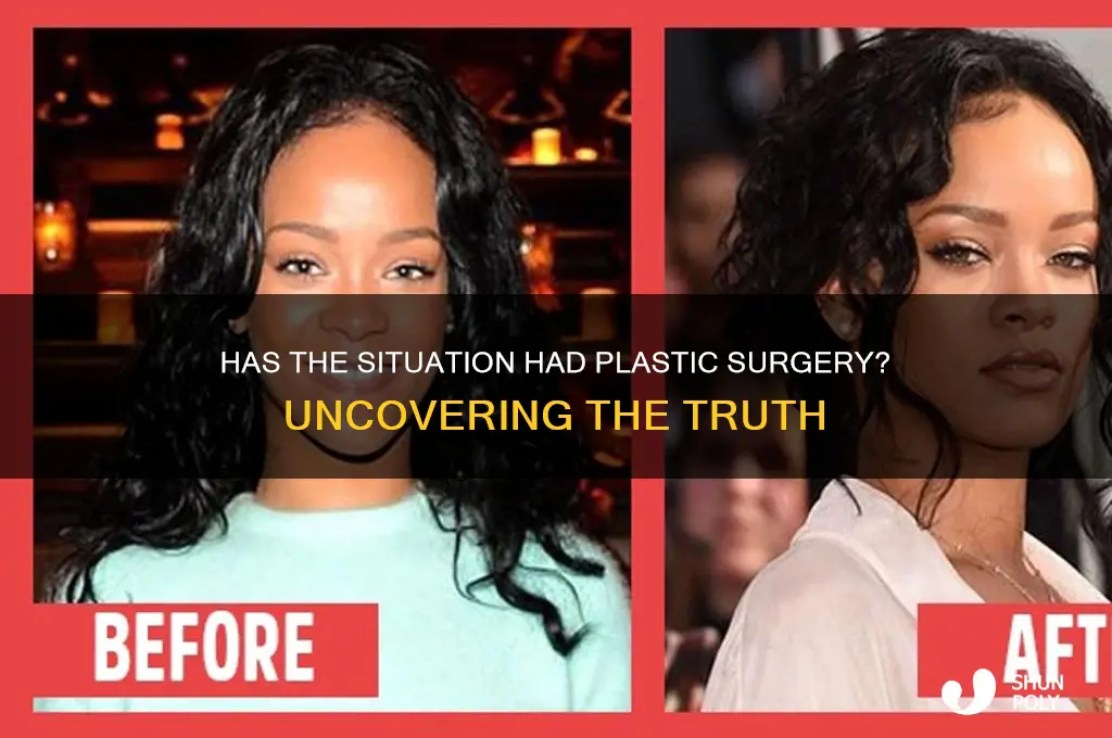 has the situation had plastic surgery