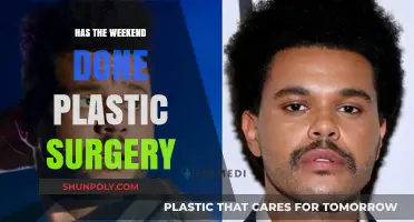 Has The Weeknd Undergone Plastic Surgery? Unveiling the Truth Behind His Look
