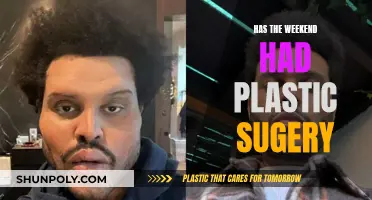 Plastic Surgery: Weekend Makeover Secrets Revealed