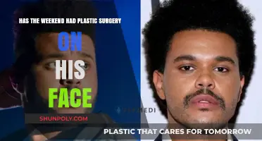 Weekend's Transformation: Plastic Surgery Rumors and Facial Changes Explored