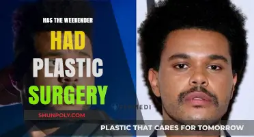 Has The Weekender Undergone Plastic Surgery? Speculations and Facts