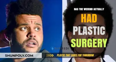 The Weeknd's Transformation: Uncovering the Truth About Plastic Surgery