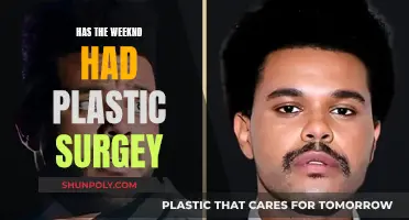 The Weeknd's Transformation: Plastic Surgery Speculation