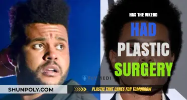 Has The Weeknd Undergone Plastic Surgery? Uncovering the Truth Behind His Look