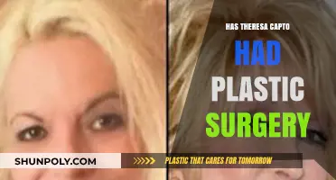 Theresa Caputo Plastic Surgery: Fact-Checking the Long Island Medium's Transformation