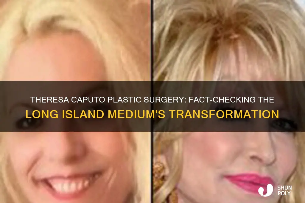 has theresa capto had plastic surgery