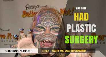 Tiger's Transformation: Uncovering the Truth About Plastic Surgery Rumors