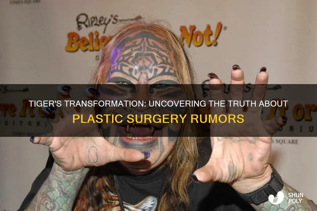 has tiger had plastic surgery