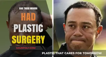 Tiger Woods Plastic Surgery: Fact-Checking the Rumors and Speculations