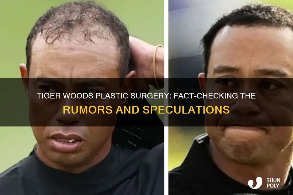 has tiger woods had plastic surgery