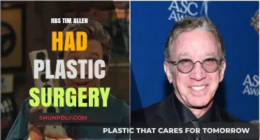 Tim Allen's Transformation: Plastic Surgery Rumors Explored and Debunked