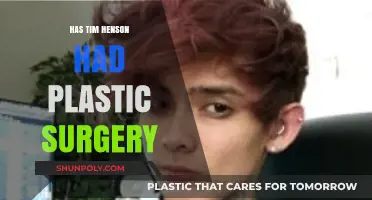 Tim Henson Plastic Surgery: Fact-Checking the Rumors and Speculations