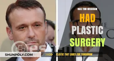 Tim McGraw's Transformation: Plastic Surgery Rumors and Reality Revealed