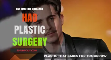 Timothée Chalamet's Transformation: Plastic Surgery Rumors Explored