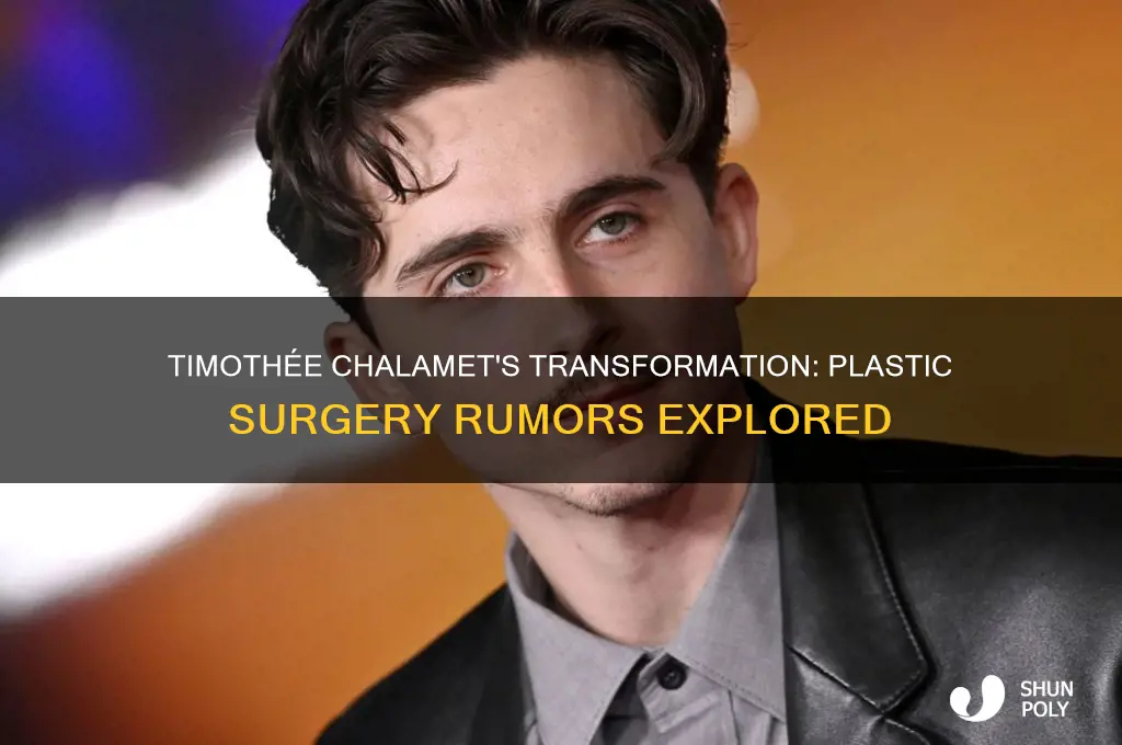 has timothee chalamet had plastic surgery