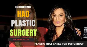 Has Tina Knowles Had Plastic Surgery? Uncovering the Truth