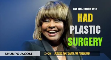 Tina Turner's Transformation: Plastic Surgery Rumors and Reality Revealed