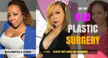Has Tiny Had Plastic Surgery? Uncovering the Truth Behind Her Look