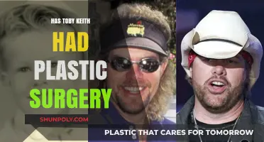 Has Toby Keith Had Plastic Surgery? Uncovering the Truth
