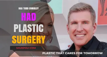 Has Todd Chrisley Had Plastic Surgery? Unveiling the Truth