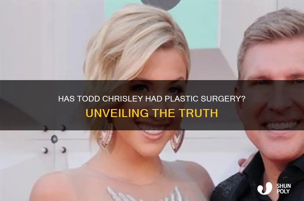 has todd chrisley had plastic surgery