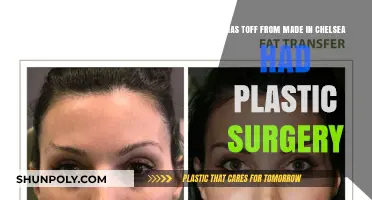 Toff's Transformation: Plastic Surgery Rumors in Made in Chelsea