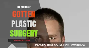 Tom Brady's Changing Looks: Plastic Surgery Rumors Explored