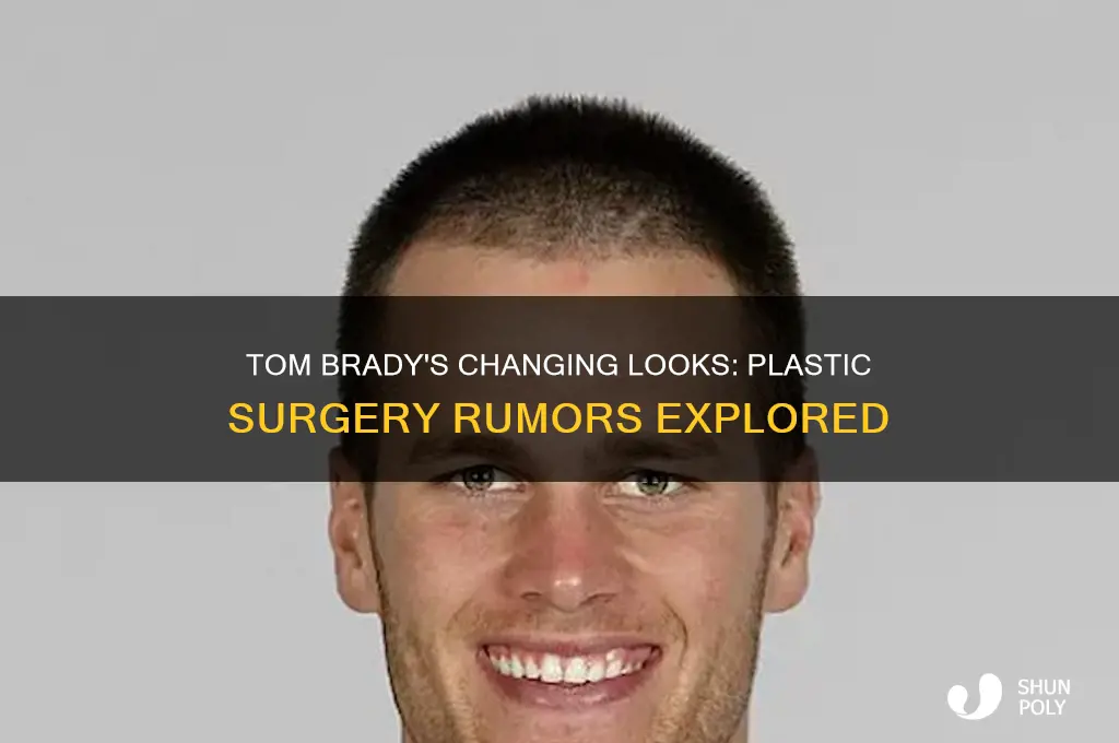 has tom brady gotten plastic surgery
