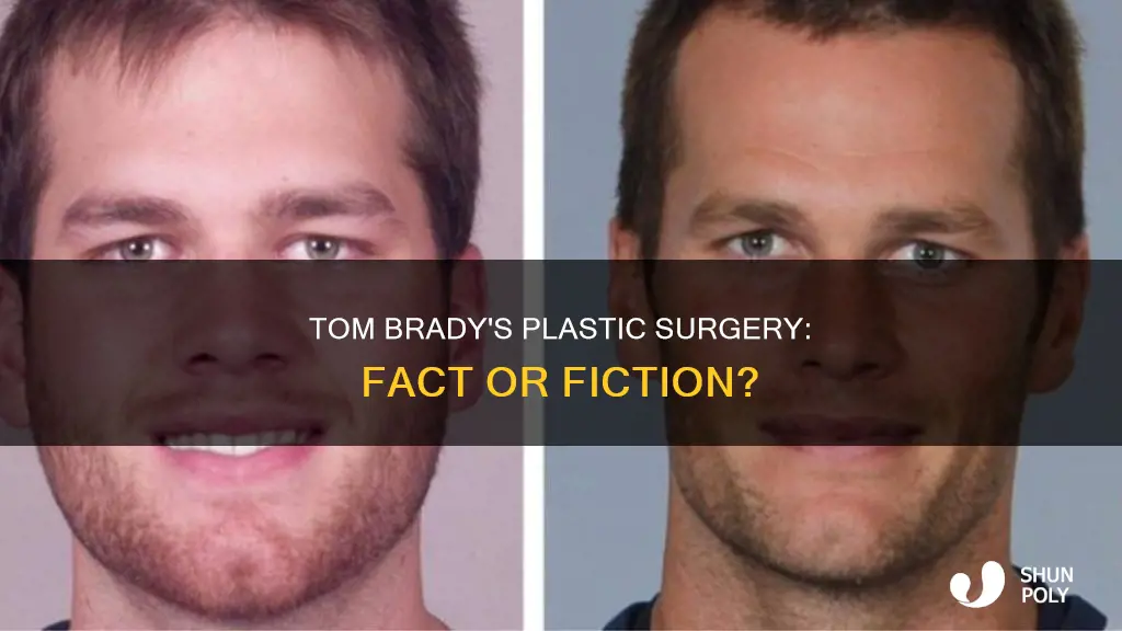 has tom brady had plastic surgey