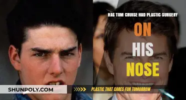 Tom Cruise's Nose: Natural or Plastic Surgery Transformation?