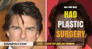Has Tom Cruise Had Plastic Surgery? Unveiling the Truth Behind the Rumors