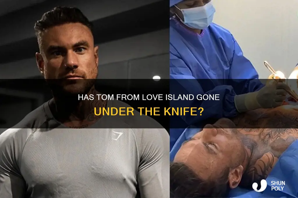 has tom from love island had plastic surgery