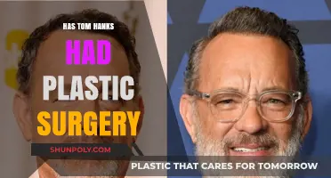 Tom Hanks Plastic Surgery: Fact or Fiction? Uncovering the Truth