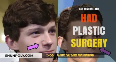 Tom Holland Plastic Surgery: Fact or Fiction? Unveiling the Truth