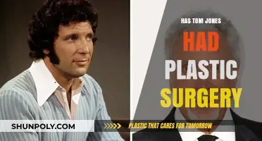 Tom Jones Plastic Surgery: Fact-Checking the Rumors and Speculations