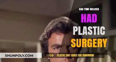 Tom Selleck's Changing Looks: Plastic Surgery Rumors Explored