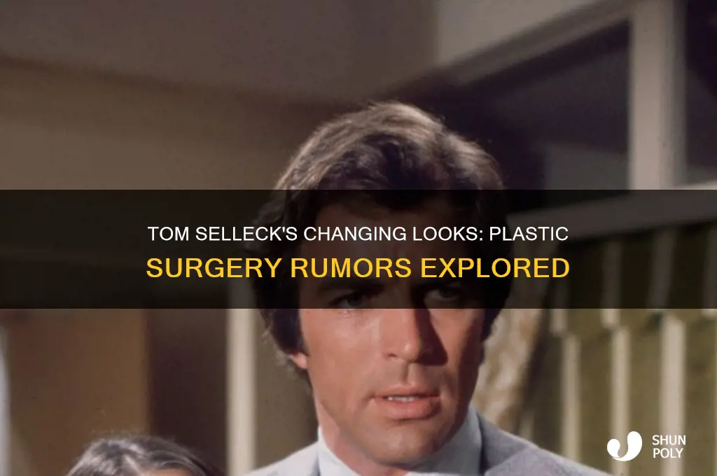 has tom selleck had plastic surgery
