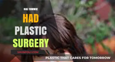 Has Tommie Had Plastic Surgery? Uncovering the Truth and Speculations