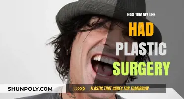 Tommy Lee's Transformation: Plastic Surgery Rumors and Reality Revealed